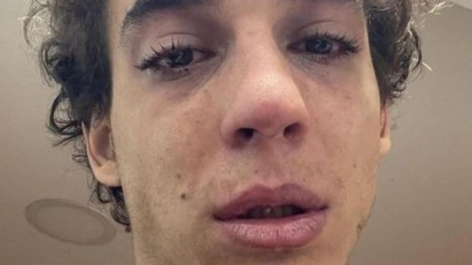 Preocupación por la confesión de uno de los actores de La casa de papel: "Ya no quiero hablar, ni comer"