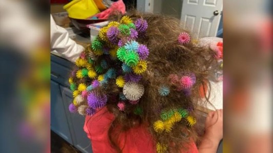 La odisea de una mamá para desenredar el pelo de su hija: se le habían pegado 150 juguetes