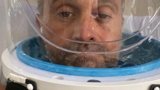 Qué es el "Helmet" que le colocaron a Sergio Lapegüe para su tratamiento por covid