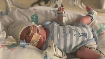 La historia del "bebé guerrero": nació prematuro, pesó 765 gramos, supero el coronavirus y una infección