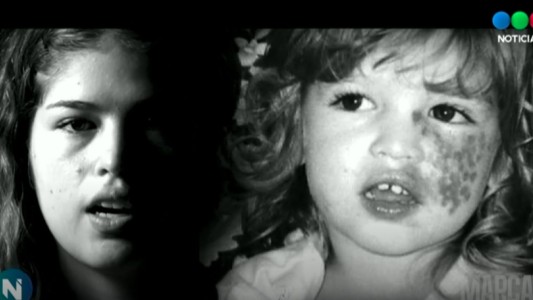 Marcas: el temor de Agustina a la mancha de su cuerpo