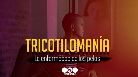 La tricotilomanía, otra enfermedad que se agravó en la pandemia