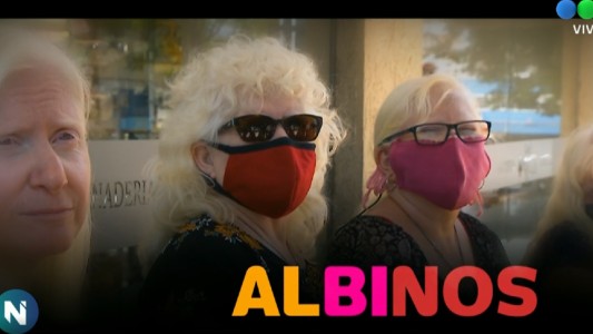Minorías: albinos