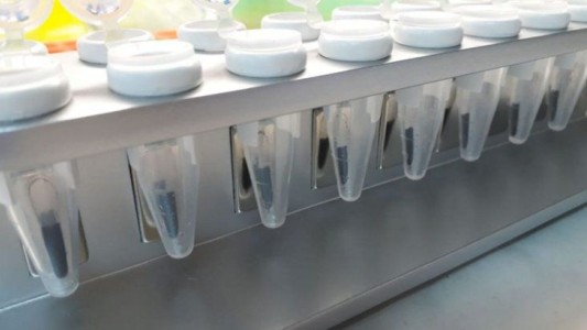 Coronavirus: científicos argentinos desarrollan un kit que acelera los testeos