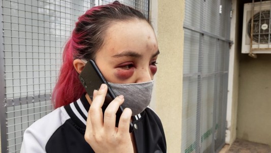 La intentaron subir a un auto y la arrastraron por la calle: "Siento un miedo terrible"