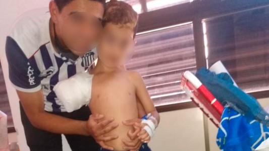 Un nene de 6 años perdió el brazo tras meterlo en el secarropas