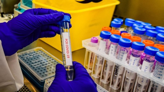 Coronavirus: identifican un caso de la cepa "doble mutante" en California