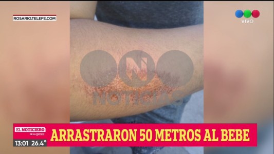 Arrastraron más de 50 metros a un bebé para robarle la bicicleta a su mamá