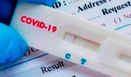 Autorizaron a vender en farmacias un test rápido de coronavirus: precio y cómo funciona