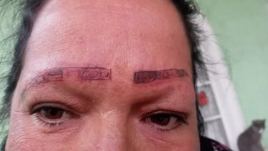 Se viralizó la denuncia de una joven por tatuadores que la estafaron y le arruinaron la cara