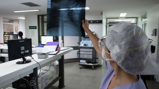 Coronavirus en Argentina: reportan 248 muertos y 20.461 casos en las últimas 24 horas