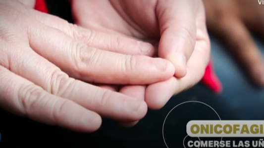 Onicofagia: los que se comen las uñas