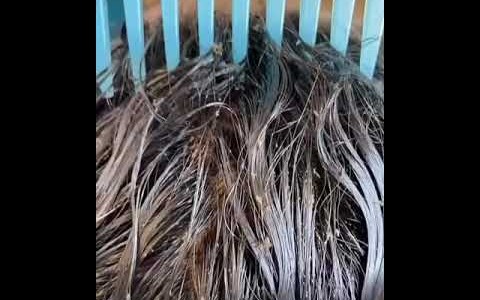 Video estremecedor: millones de piojos caminando en la cabeza de una nena