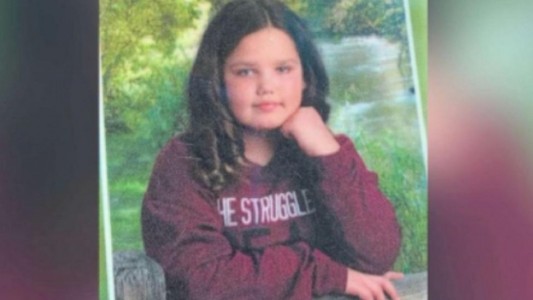 Una nena de 13 años sufrió graves quemaduras al intentar un reto viral de TikTok