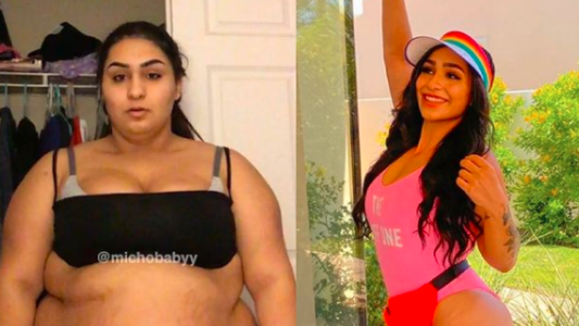 La increíble transformación de una joven con obesidad mórbida
