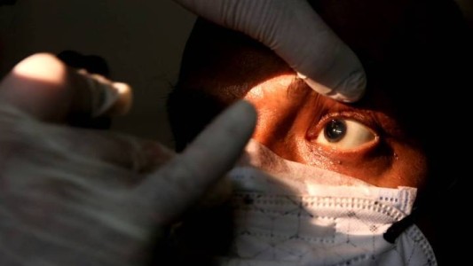 “Hongo negro”: Qué es la coinfección fúngica en Covid grave