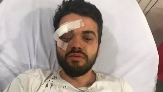 La emotiva carta del joven golpeado por una patota por ser gay: "Pensé que me mataban"