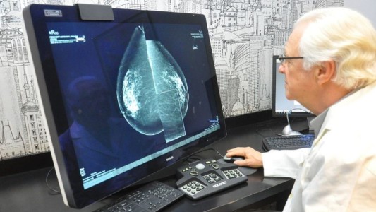 "Mamotest": Emprendimiento argentino de telemamografías en red será presentado en la ONU