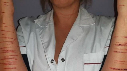 Brutal intento de violación: se resistió y el atacante le cortó todo el cuerpo