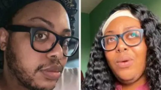 La mujer que dejó de depilarse y lo muestra en redes para normalizar el vello facial