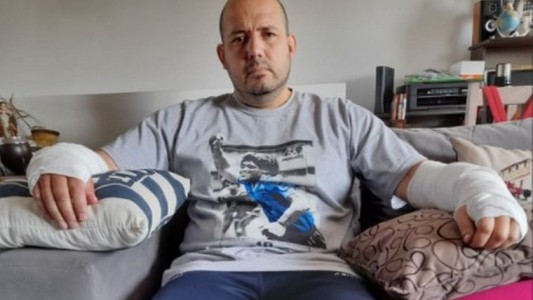 El relato dramático de un hombre que fue atacado por un perro pitbull