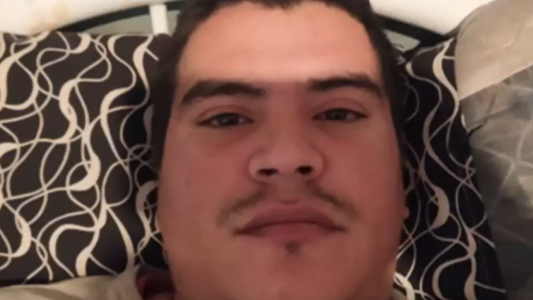 Le destrozaron la mandíbula para robarle $100 y un celular viejo: sus padres piden ayuda para una prótesis