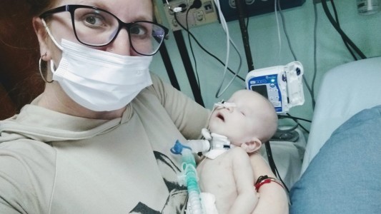 Beba de Bahía Blanca necesita viajar al Garrahan: "No tiene ojos y su cerebro no se desarrolla"