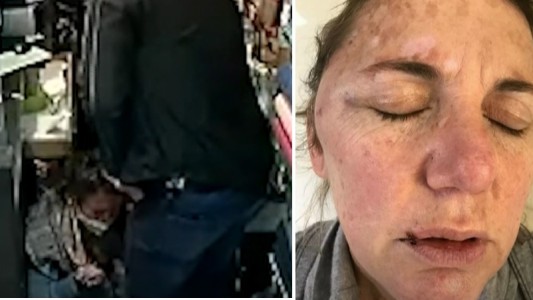 "Es duro, me vienen momentos de llorar": la pesadilla de una mujer asaltada y golpeada en su local