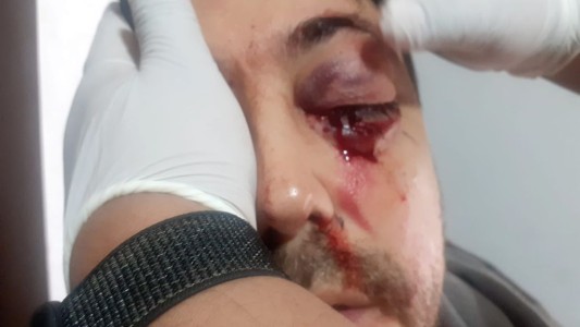 "La agresora amenazó a mi hija", dijo la esposa del hombre que perdió un ojo en una pelea