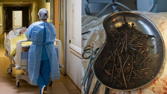 Médicos sacaron más de un kilo de clavos del estómago de un hombre