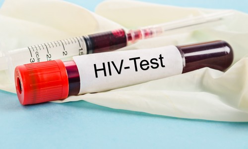 Condenaron a prisión a un joven portador de VIH por trasmitirle el virus a su novia