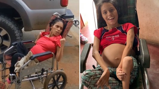 Una joven discapacitada quedó embarazada tras sufrir una violación: la familia decidió que tenga el bebé