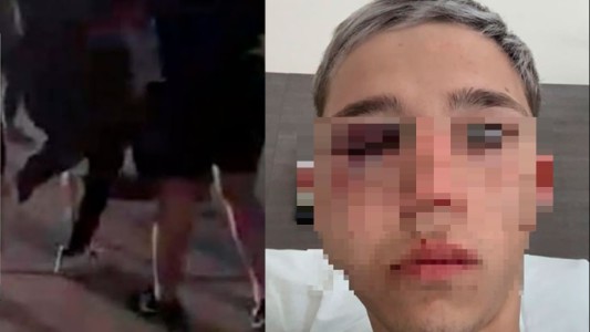 Identificaron a dos rugbiers acusados de golpear a un adolescente en una fiesta de 15