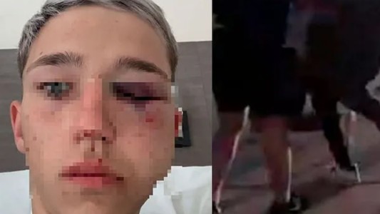 Imputan a cuatro rugbiers por la golpiza a un adolescente durante un cumpleaños en Mendoza