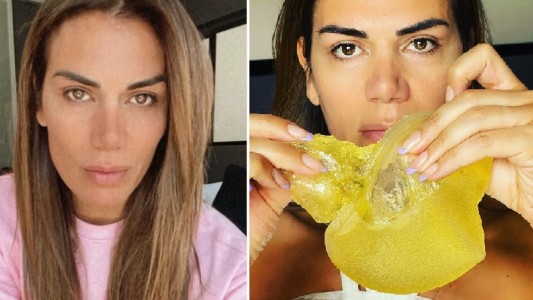 Flor de la V contó que debió operarse por una fisura en un implante mamario