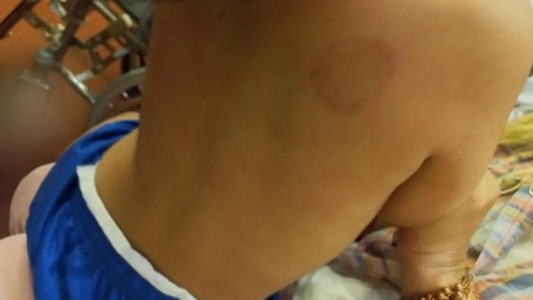 Una madre fue detenida por agredir a mordiscos a su hijo de 2 años: la denunció la abuela del menor