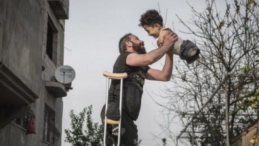 Italia, movilizada para ayudar a Mustafa: el nene sirio que no tiene ni brazos, ni piernas