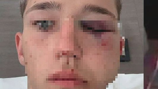 Imputarán a cuatro rugbiers en Salta por golpear a un adolescente en una fiesta