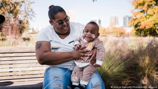 Un bebé nació a los 5 meses de gestación, pesó 420 gramos y sobrevivió: los médicos creen que es un milagro