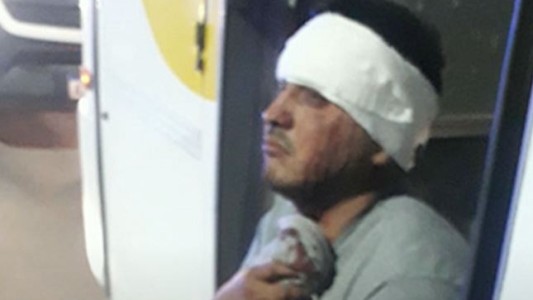 Un chofer de la línea 148 fue apuñalado por un pasajero