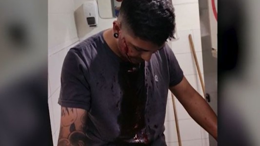 Atacaron a dos choferes: paro de colectivos de zona oeste del Conurbano