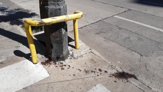 "Me cuesta asimilarlo, no caigo del todo": el relato de Milagros, la chica amputada tras un choque