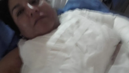 Brutal ataque de una suegra a su nuera: le arrojó una pava de agua hirviendo