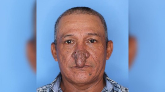 Vivía un calvario por la forma de su nariz hasta que el gesto de un cirujano cambió su vida