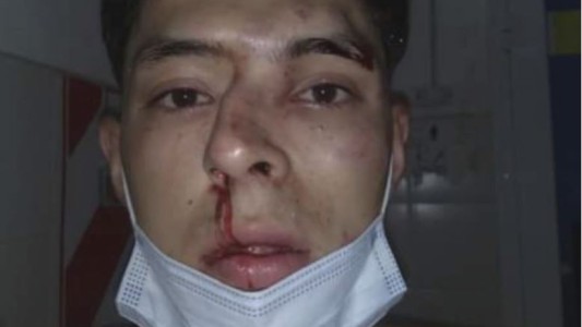 Chaco: Un estudiante de periodismo deportivo recibió una brutal paliza