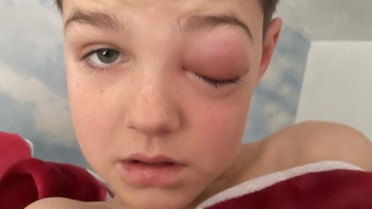 "Ojo covid": un nene de 9 años casi pierde la visión tras contagiarse coronavirus