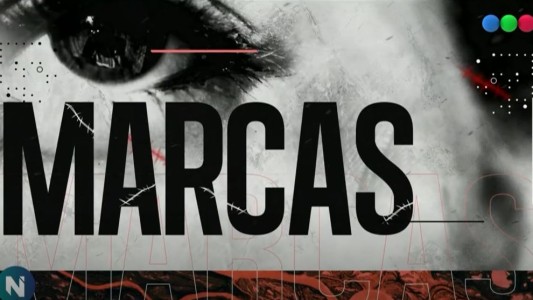 Marcas: las cicatrices de un cumpleaños que terminó en tragedia