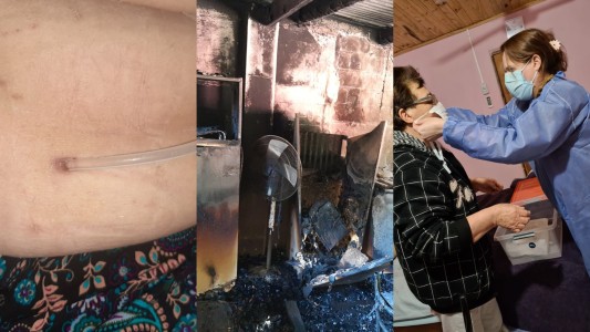 Francisca tiene 65 años, sufre insuficiencia renal, un feroz incendio destrozó por completo su casa y pide ayuda