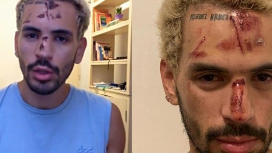 Brutal paliza a un joven por ser gay en un boliche de la costanera porteña