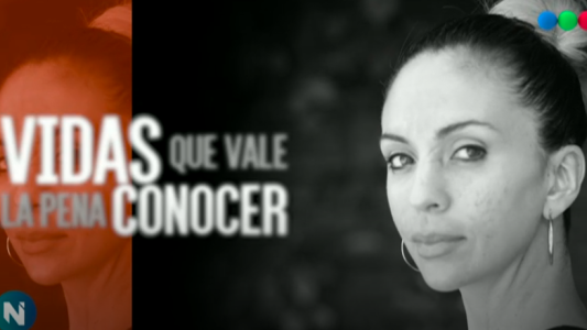 Marcas: la mordida de un perro que le cambió la vida